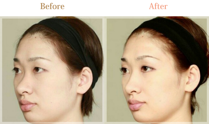 ビフォーアフター01