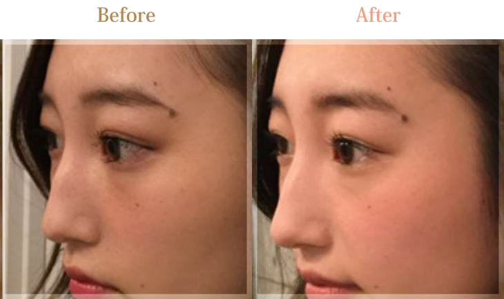 ビフォーアフター03